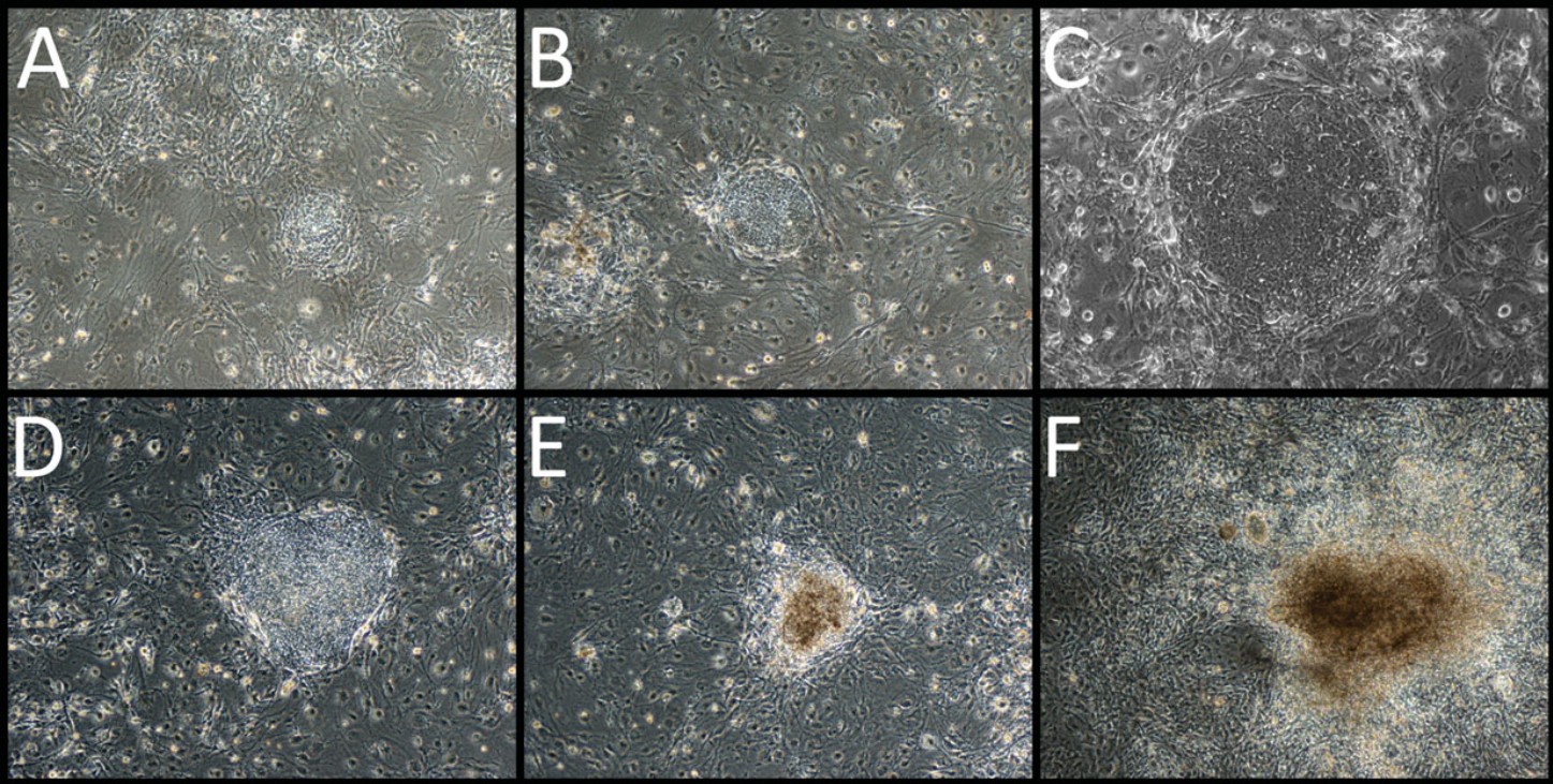 Single-cell RNA-seq trajectory – synthetic embryogenesis
